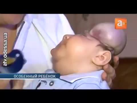 Баш сөөгү жок бала