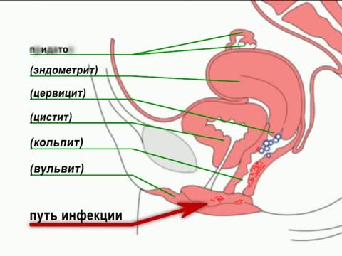 Аялдардын жыныстык оорулары..